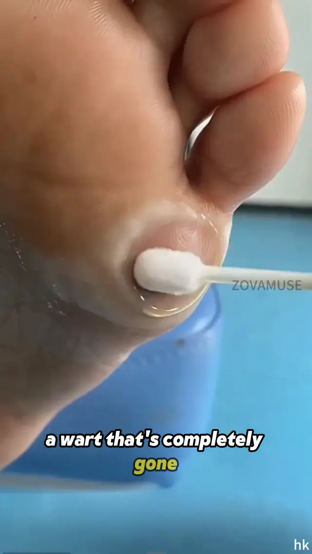 ZovaMuse+